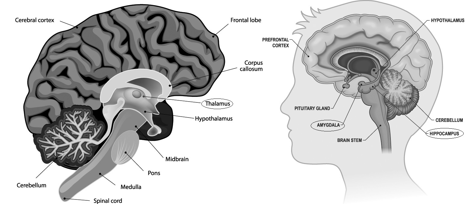 Figure 2: Trauma in the Brain